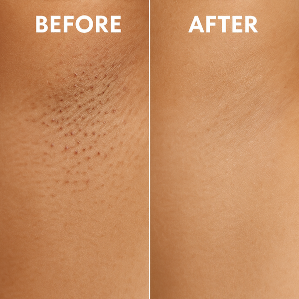 SmoothGuard Soothing Liquid